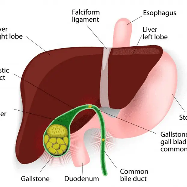 Avoiding Dialysis