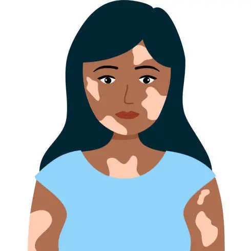 Leucoderma
