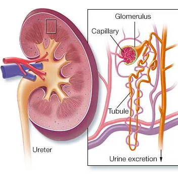 Nephrotic Syndrome